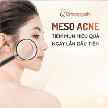 Meso Acnes - Công nghệ thẩm mỹ an toàn hiệu quả cho da mụn