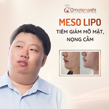 Meso Lipo - Công nghệ thẩm mỹ tiêm giảm mỡ mặt, nọng cằm