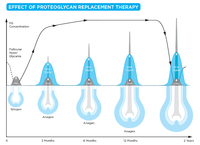 Tác động của liệu pháp bổ trợ Proteoglycan